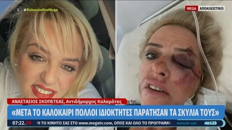 Άγρια επίθεση σκύλων στην Καλαμάτα – Σώθηκε από θαύμα 34χρονη