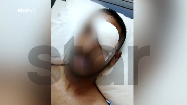 Ραφήνα: Νεαρός καταγγέλλει ότι έχασε το μάτι του από πυροβολισμό – «Στόχευε προς το μέρος μας, η πρώτη σφαίρα πέτυχε εμένα» – rpn