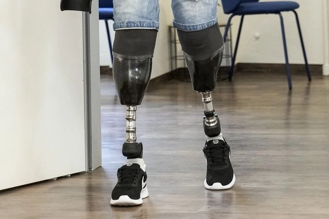 Χειρουργός έκοψε τα πόδια του για να ικανοποιήσει μια σεξουαλική εμμονή