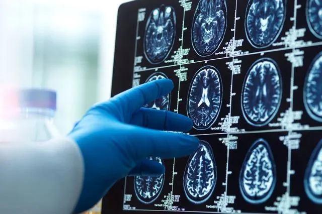 Εγκέφαλος: Σε ποιες κρίσιμες ηλικίες αλλάζει δραματικά